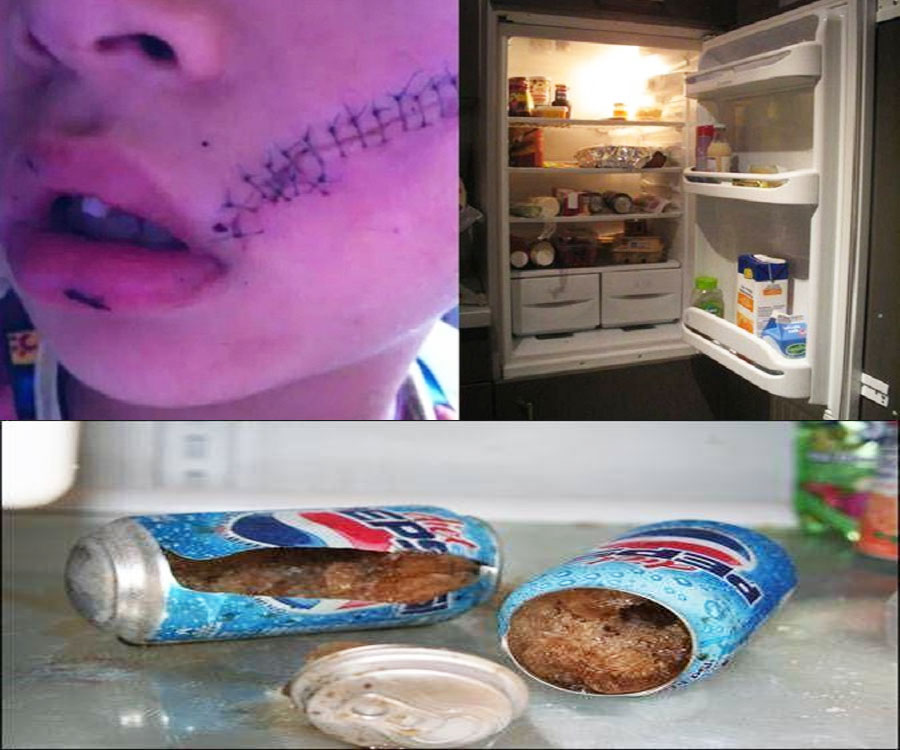 Cảnh báo: Nhập viện cấp cứu chỉ vì để lon Pepsi trong tủ đông đá
